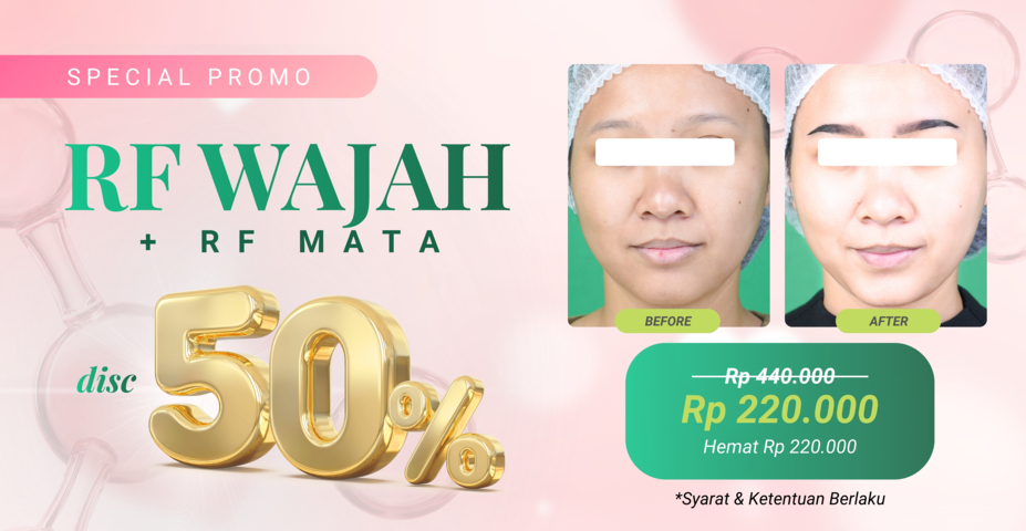 2.jpg (FILEminimizer)